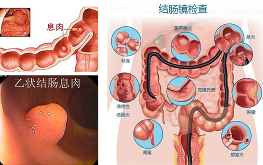 泉州医博肛肠医院怎么检查胃病